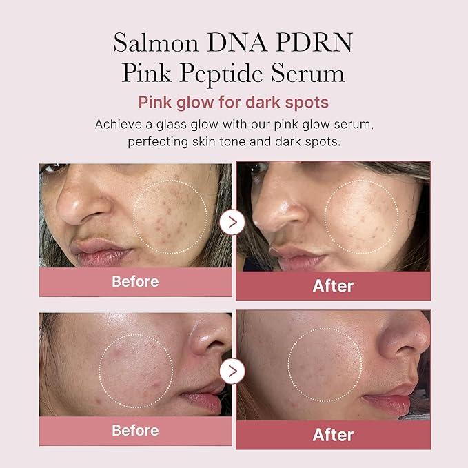 🩷 Medicube Salmon DNA PDRN Pink Peptide Serum | Korean Glow Serum (1.01 fl.oz.)