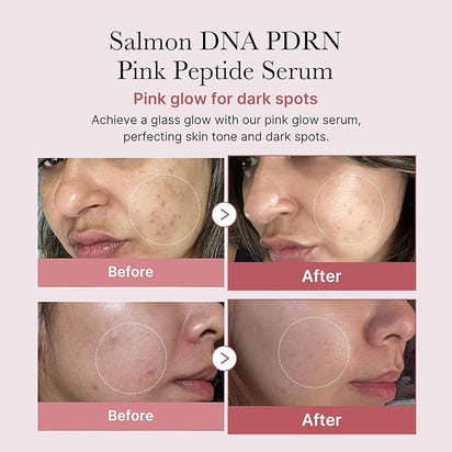 🩷 Medicube Salmon DNA PDRN Pink Peptide Serum | Korean Glow Serum (1.01 fl.oz.)
