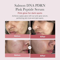 🩷 Medicube Salmon DNA PDRN Pink Peptide Serum | Korean Glow Serum (1.01 fl.oz.)